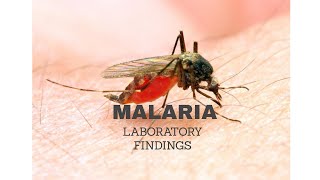 8MALARIA Laboratory findings [upl. by Katharine]