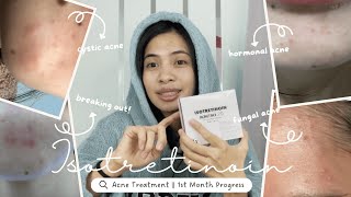 Accutane Journey  One Month Progress Road to Clear Skin [upl. by Ennovoj767]