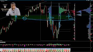 Analisi Volumetrica  Aggiornamento Es e Nq 14 12 2021 [upl. by Allenod]