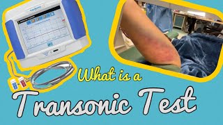 What is a Transonic test  Dialysis💉 [upl. by Zullo496]