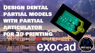 exocad model creator partial model and articulator [upl. by Kalb396]