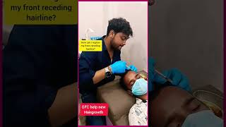 Does hair grow back after receding hairline  GFC bes scenic for hairgrowth malda wb India hair [upl. by Sung2]