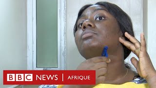 Chidube une femme qui souffre dhirsutisme et qui encourage les autres sur les réseaux sociaux [upl. by Hsur]