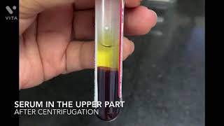 How is serum extracted from the blood sample [upl. by Ahsienom]