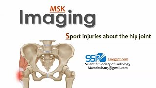 Sport injuries hip joint imaging DRE Prof Mamdouh Mahfouz [upl. by Cinomod]