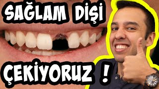 Ortodontik Diş Çekimi   Diş Çekmeden Olmaz mı  quot  Dr Deniz Ertüz [upl. by Aramat718]