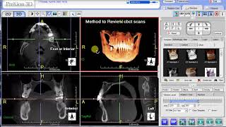 PreXion Training Tips CBCT Review Methodology [upl. by Sharman]