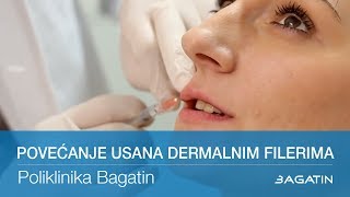 Povećanje usana dermalnim filerima [upl. by Merrilee755]