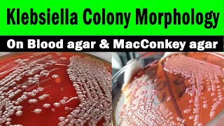 Klebsiella colony morphology on macConkey agar  Blood agar Clear explanation with live video [upl. by Ugo]