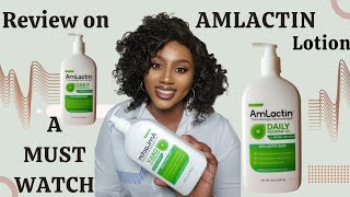 Review on Amlactin lotion 12 lactic acid [upl. by Laemaj]