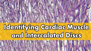 Fibrocartilage vs Cardiac Muscle Histology FAQ [upl. by Ymot]