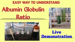 Albumin globulin ratio  Total protein estimation  Biuret method  Albumin estimation  BCG method [upl. by Lynnett]