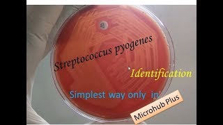 Streptococcus pyogenes identification [upl. by Anuat]