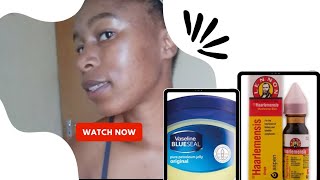 Vaseline and Haarlemensis Hack for Dark spots Does it work [upl. by Pravit]