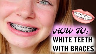 HOW I MAINTAIN WHITE TEETH WITH BRACES [upl. by Fessuoy781]