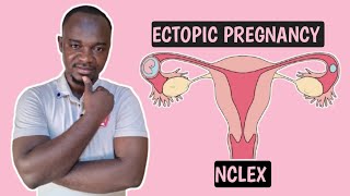 ECTOPIC PREGNANCY for nurses and all NCLEX student [upl. by Ronen969]