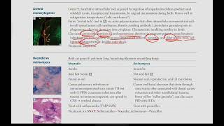 Listeria Monocytogenes Nocardia vs Actinomyces  Microbiology  13  First Aid USMLE in UrduHindi [upl. by Grosvenor]