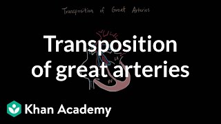 Transposition of great arteries  Circulatory System and Disease  NCLEXRN  Khan Academy [upl. by Stew]