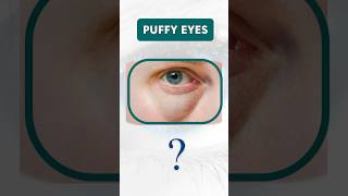 quotCauses of Puffy Eyes Understanding and Remedies for Refreshed Eyes 👁️🌿 EyeHealth PuffyEyesquot [upl. by Skipp]