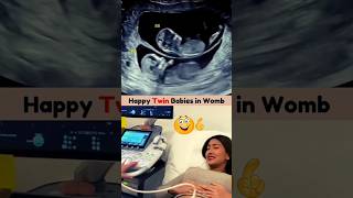 Emotional Twin Ultrasound Scan 🥰💯 Twin ultrasound pregnancy [upl. by Sheela]