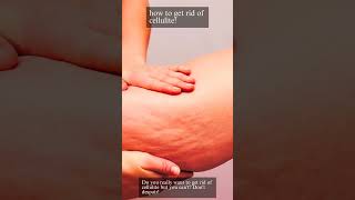 How To Get Rid Of Cellulite cellulitis skincare [upl. by Emmeram]