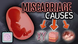 Dr Morris Ultimate Guide to Recurrent Miscarriage Testing [upl. by Ysteb]