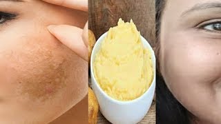 pigmentation home remedy get clear Spotless skin with this remedy kaurtips [upl. by Ssidnac139]