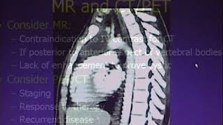 Evaluation of Mediastinal Pathology [upl. by Ielhsa]