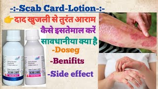 Scab card lotion use in hindi दाद खुजली को जड़ से खत्म करे medicine medical raj pharmacy use [upl. by Tegirb819]