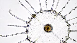 The Microscopic Life of Venice What lives in the Canals [upl. by Hakan]