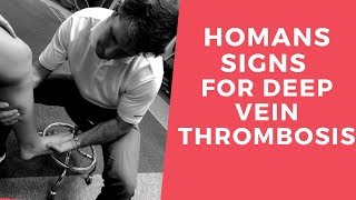 Homans Sign for Deep Vein Thrombosis [upl. by Zaid]