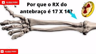 Anatomia radiológica Antebraço em AP e perfil nível básico [upl. by Greenes]