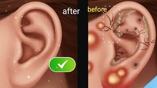 External treatment of the ear  asmr [upl. by Ynohtnakram]