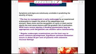 Esophagus Lec 2  First Part [upl. by Labana295]