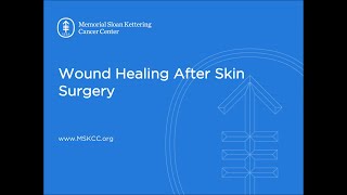 Wound Healing After Skin Surgery  Memorial Sloan Kettering [upl. by Fasa]