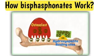 Mechanism action of bisphasphonates  How bisphasphonates work  Doctors goal [upl. by Eelanej]