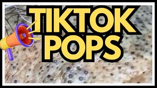 TikTok PIMPLES Popped [upl. by Ellard]