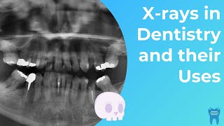 Types of Dental Xrays you NEED to know  Dental Radiographs and Why we use them [upl. by Trueman]