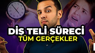 5 DAKİKADA DİŞ TELİ   Diş Teli Nasıl Takılır  Dr Dt Deniz Ertüz Ortodontist [upl. by Ellehcal]