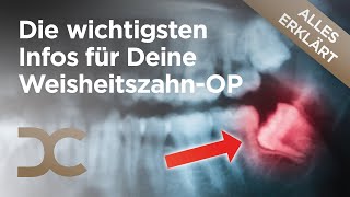 Weisheitszähne entfernen Alles zur schonenden WeisheitszahnOP in Dämmerschlaf  Dorow Clinic [upl. by Camille50]