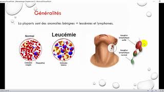 1 Anomalies de plusieurs lignées sanguines Augmentation globulaire [upl. by Hopkins477]