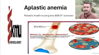 aplastic anemia pediatric health nursing kmu BSN 5th semester [upl. by Eirellam]