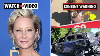 Anne Heche Ellen DeGeneres’ exgirlfriend severely burned after LA crash [upl. by Hamel]