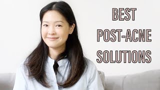 Best PostAcne Treatments for Red Marks  Bumpy Skin  PIE [upl. by Doroteya893]