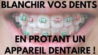 Comment Blanchir Vos Dents en Portant Un Appareil Dentaire [upl. by Adnohsar108]