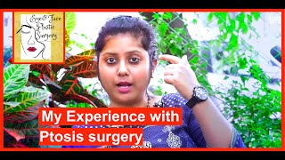 My experience with Eyelid Ptosis surgery [upl. by Orimisac]