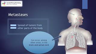 Briefly explained Metastases [upl. by Amik604]