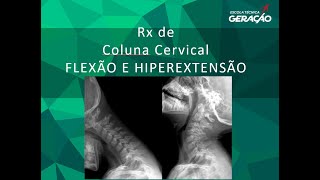 Radiografia da Coluna Cervical Dinâmicas  Flexão e Hiperextensão [upl. by Olemrac701]