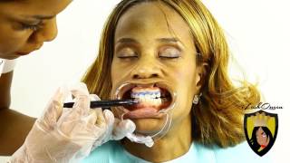 TEETH WHITENING TUTORIAL How to Start a TEETH Whitening Business amp Is Teeth Whitening Legal [upl. by Niggem214]