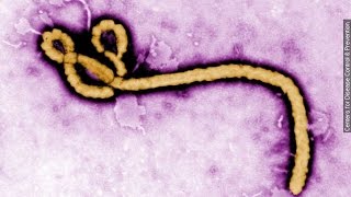 Alabama Man Tests Negative For Ebola  Newsy [upl. by Pevzner496]